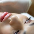 Framed In Style: Lip Fillers In Chicago To Complement Your New Hairstyle