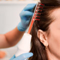 Unlock Your Hair Potential: Laser Hair Restoration And Hairstyling In Westlake Village