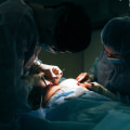 Style And Confidence: How Breast Augmentation And Professional Hairstyling Can Transform Your Appearance In Danville, CA